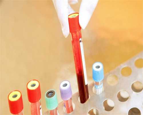 香港生男生女验血单怎么看,中国疾控中心主任医师表示：接种新冠疫苗不影响